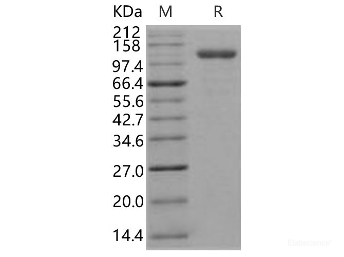 Recombinant Human Endoglin / CD105 / ENG Protein (Fc tag)-Elabscience