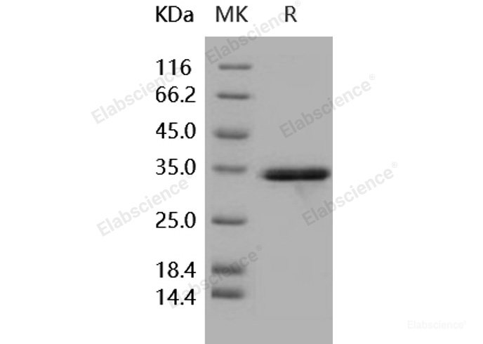 Recombinant Human IL-1 beta / IL1B Protein (pro form, His tag)-Elabscience
