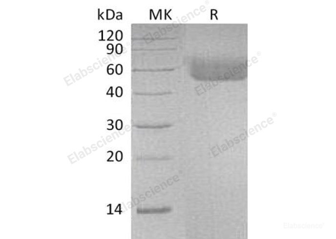 Recombinant Human IL1R1 Protein-Elabscience