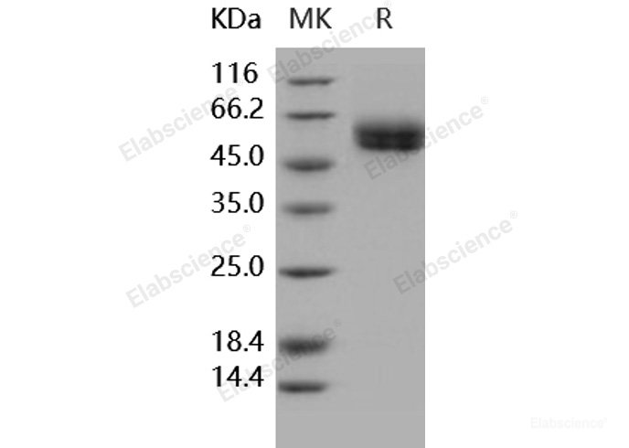 Recombinant Human IL1R1 / CD121a Protein (His tag)-Elabscience