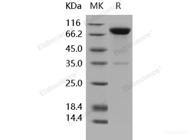 Recombinant Human IL1R1 / CD121a Protein (Fc tag)-Elabscience