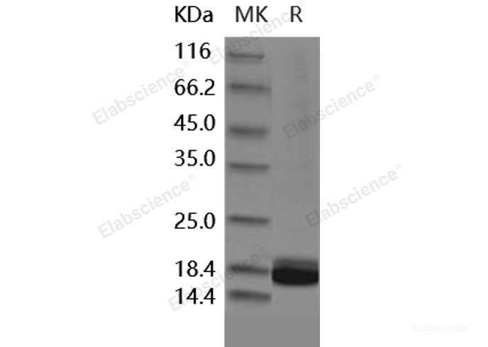 Recombinant Human IL1F5 / IL36RN Protein-Elabscience