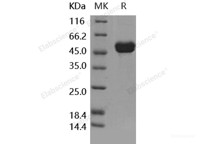 Recombinant Human IL-1RA / IL1RN Protein (Fc tag)-Elabscience