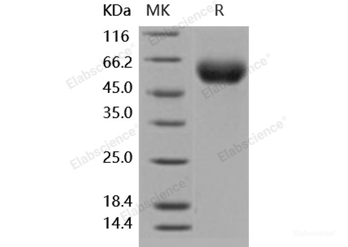 Recombinant Human IL-1RAcP / IL-1R3 Protein (His tag)-Elabscience