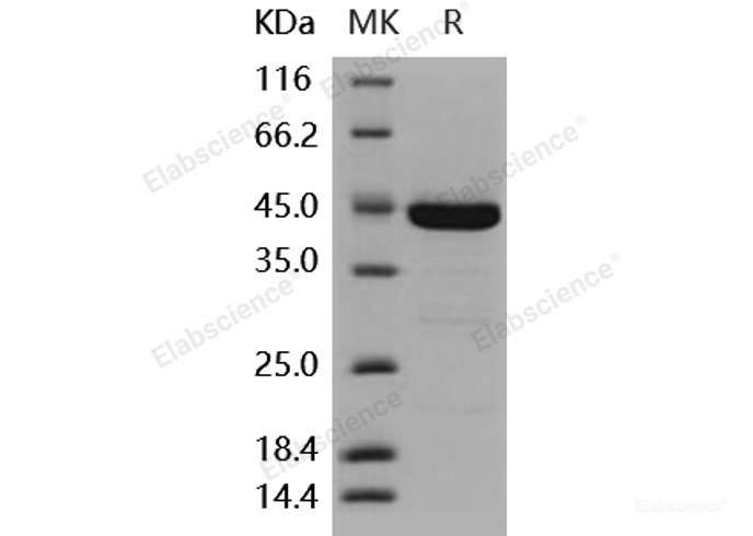 Recombinant Human DUSP3 / VHR Protein (His & GST tag)-Elabscience