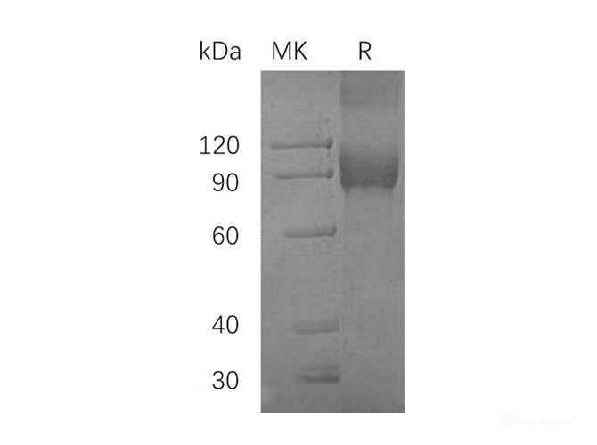Recombinant Human VCAM1 Protein (Fc Tag)-Elabscience