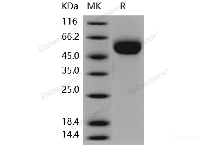 Recombinant Human IL1R2 / IL1RB / CD121b Protein (His tag)-Elabscience