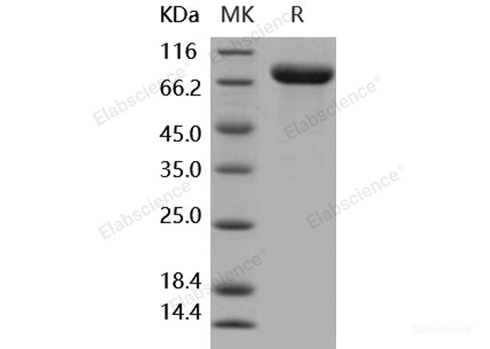 Recombinant Human IL1R2 / CD121b Protein (Fc tag)-Elabscience