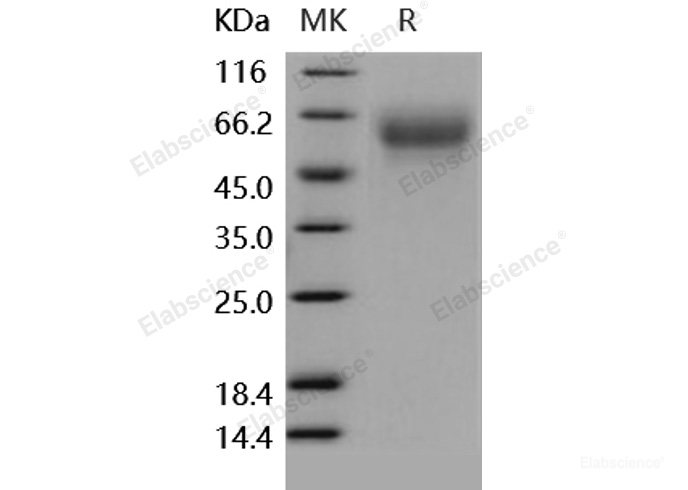 Recombinant Human CD155 / PVR Protein (His tag)-Elabscience