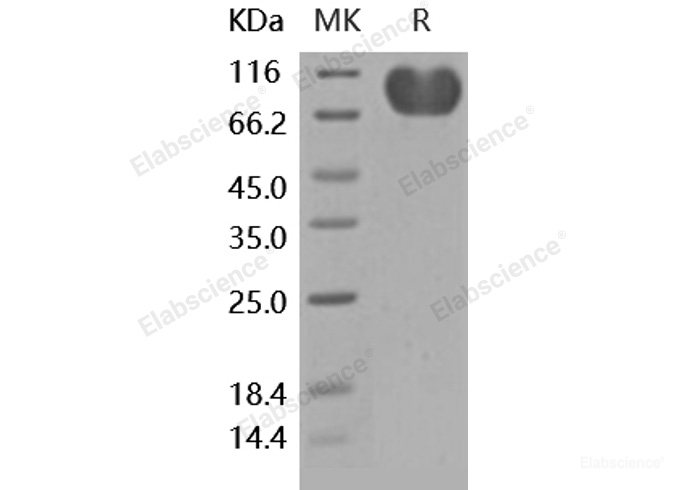 Recombinant Human CD155 / PVR / NECL5 Protein (Fc tag)-Elabscience