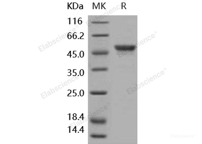 Recombinant Human Carbonic Anhydrase IX / CA9 Protein (His tag)-Elabscience