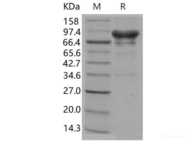 Recombinant Human Carbonic Anhydrase IX / CA9 Protein (Fc tag)-Elabscience