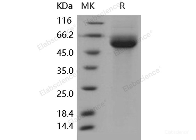 Recombinant Human IL1RL1 / ST2 Protein (His tag)-Elabscience