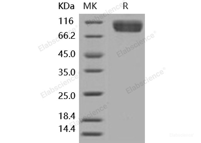 Recombinant Human IL1RL1 / DER4 Protein (Fc tag)-Elabscience