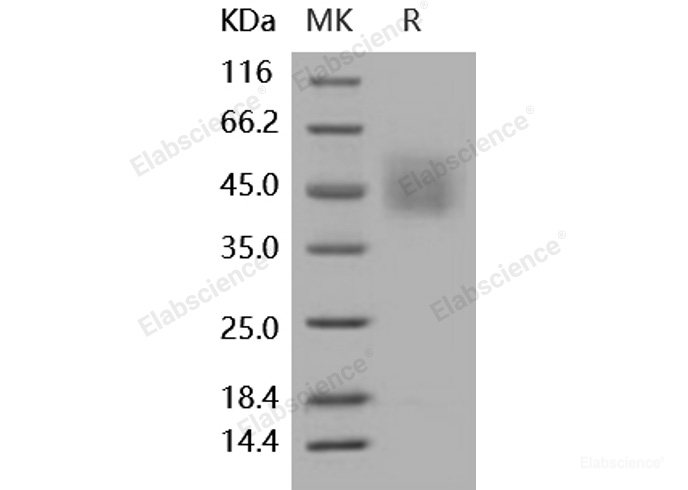 Recombinant Human CD34 Protein (His tag)-Elabscience
