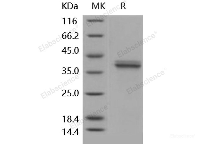 Recombinant Human Cathepsin V / Cathepsin L2 / Preproprotein Protein (His tag)-Elabscience