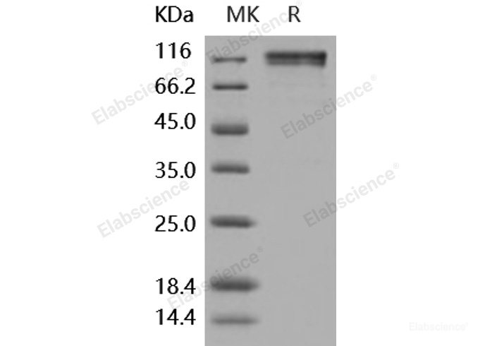 Recombinant Human CD45 / PTPRC Protein (Fc tag)-Elabscience