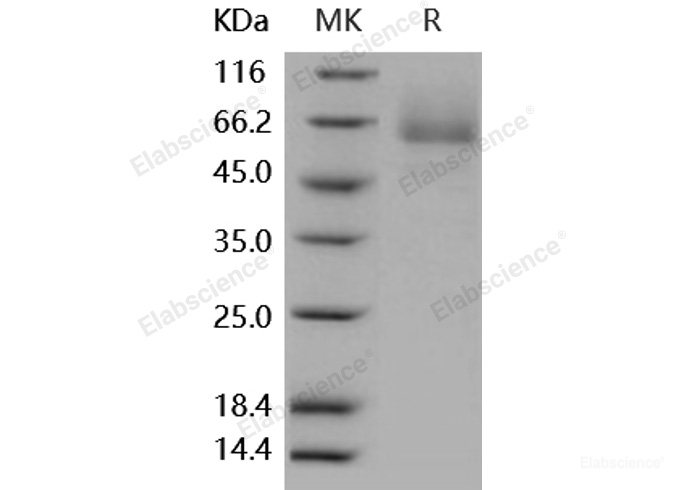 Recombinant Human Glypican 5 / GPC5 Protein (His tag)-Elabscience