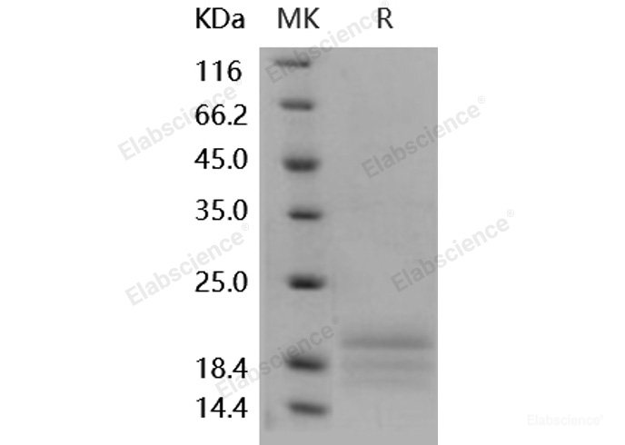 Recombinant Human AgRP / AGRP Protein (His tag)-Elabscience