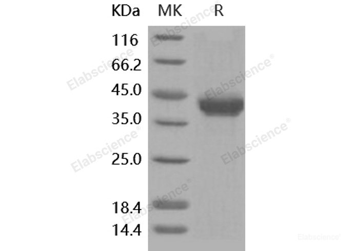 Recombinant Human AgRP Protein (Fc tag)-Elabscience
