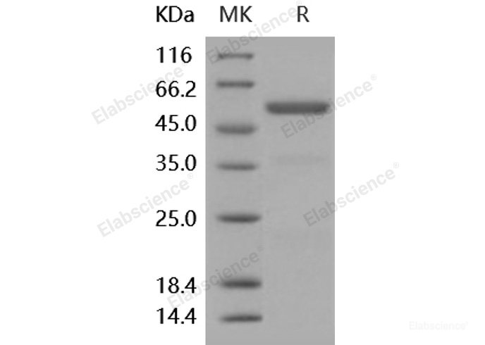 Recombinant Human Carboxypeptidase E / CPE Protein (His tag)-Elabscience