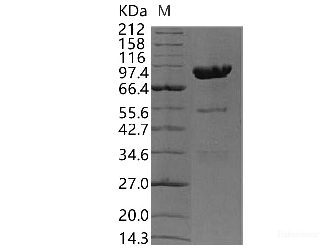 Recombinant Human Carboxypeptidase E / CPE Protein (Fc tag)-Elabscience