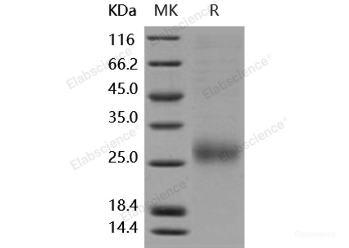 Recombinant Human ALK-1 / ACVRL1 Protein (His tag)-Elabscience