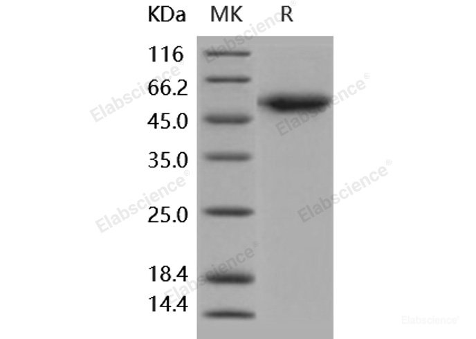 Recombinant Human ALK-1 / ACVRL1 Protein (Fc tag)-Elabscience
