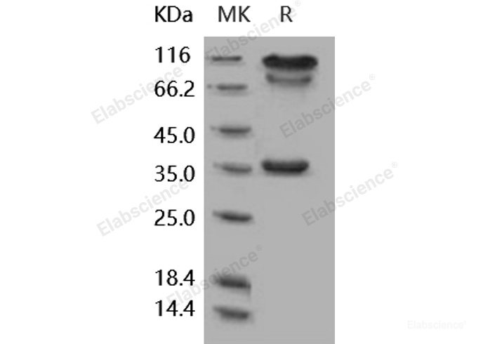 Recombinant Human BACE1 / ASP2 Protein (Fc tag)-Elabscience
