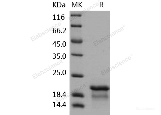 Recombinant Human NPM1 / Nucleophosmin Protein (His tag)-Elabscience