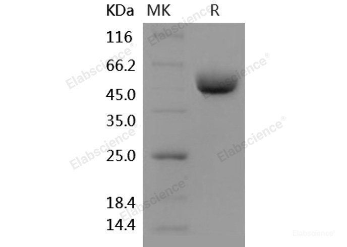 Recombinant Human ANPEP / CD13 Protein (603 Met/Ile, His tag)-Elabscience