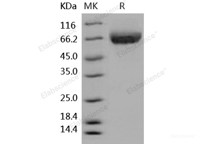 Recombinant Human ALCAM / CD166 Protein (His tag)-Elabscience