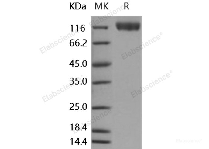 Recombinant Human VEGFR2 / Flk-1 / CD309 / KDR Protein (His tag)-Elabscience