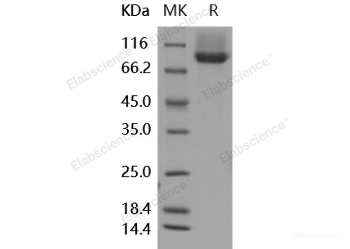 Recombinant Human Neuropilin-1 / NRP1 / CD304 Protein (His tag)-Elabscience
