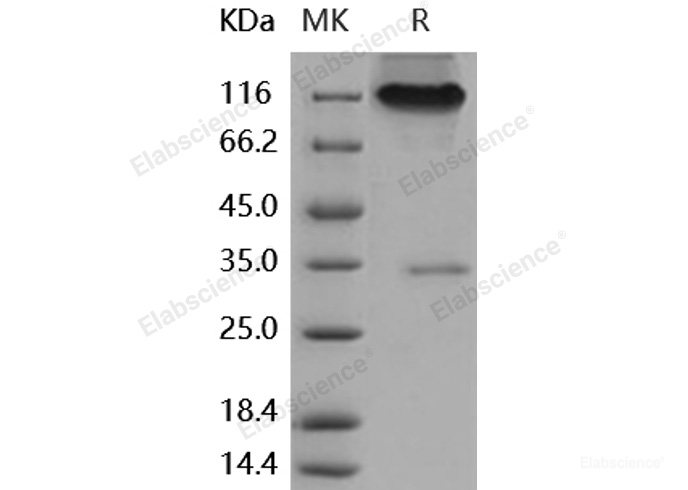 Recombinant Human Neuropilin-1 / NRP1 Protein (Fc tag)-Elabscience