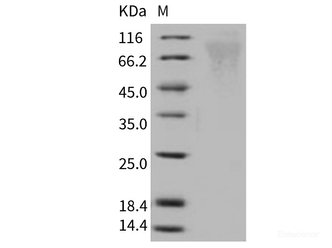 Recombinant Human respiratory syncytial virus (RSV) (A, rsb1734) glycoprotein G / RSV-G Protein (93% Homology) (His Tag)-Elabscience