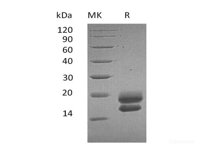 Recombinant Human VEGF-A/VEGF121 Protein (C-6His)-Elabscience