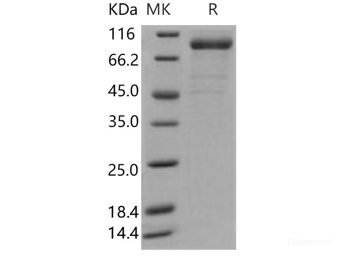 Recombinant Human IL-35 (IL12A &EBI3 Heterodimer) Protein (Fc Tag)-Elabscience