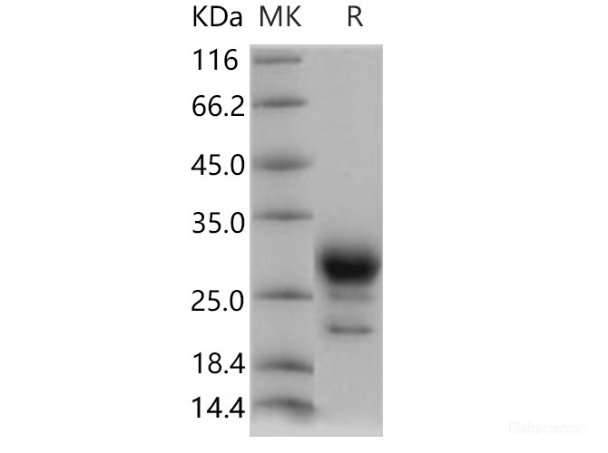 Recombinant Human Prostaglandin D Synthase Protein (His Tag)-Elabscience