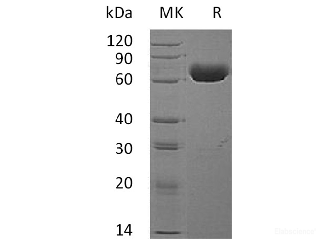 Recombinant Human Ephrin type-A receptor 4 Protein-Elabscience