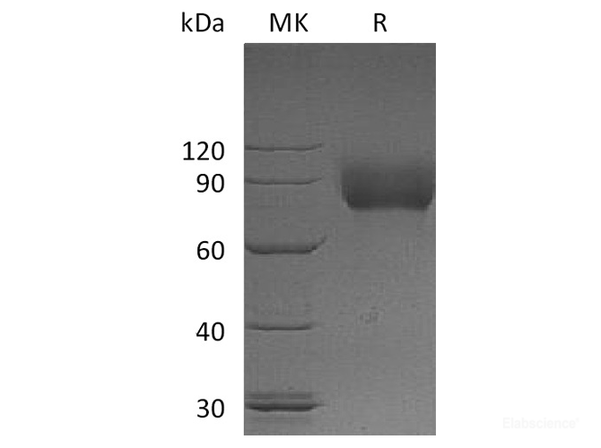 Recombinant Human Macrophage Colony-stimulating Factor 1 Receptor Protein-Elabscience