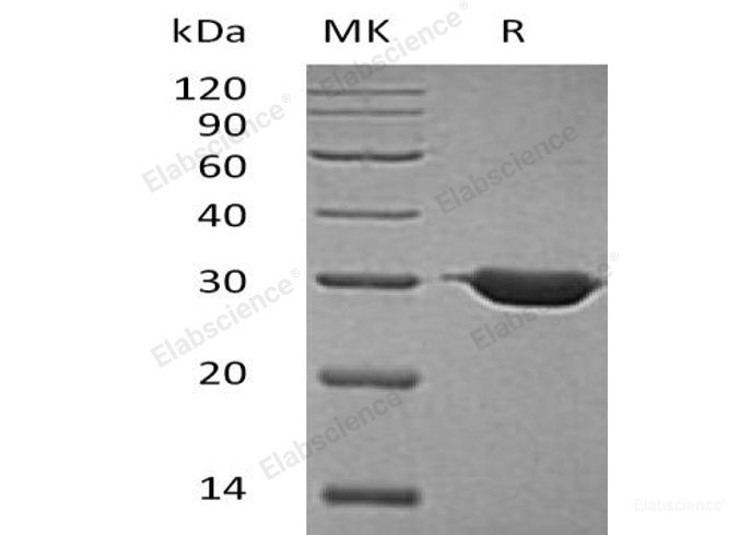 Recombinant Human 3-Hydroxybutyrate Dehydrogenase Type 2/BDH2/DHRS6 Protein(N-6His)-Elabscience