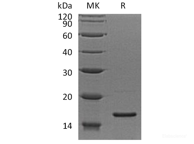 Recombinant Human 40S Ribosomal Protein S19/RPS19 Protein-Elabscience