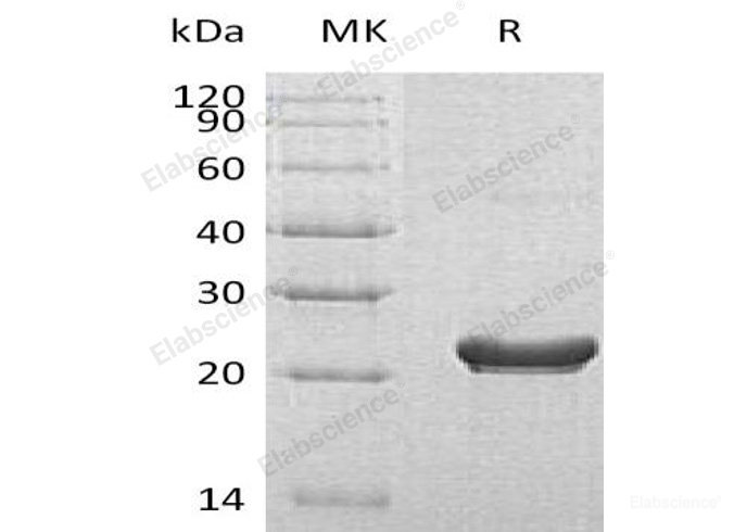 Recombinant Human 40S Ribosomal Protein S7/RPS7 Protein(C-6His)-Elabscience