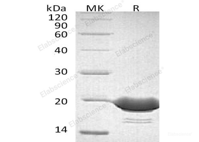 Recombinant Human 4-1BB Ligand/4-1BBL/TNFSF9/CD137L Protein(C-6His)-Elabscience