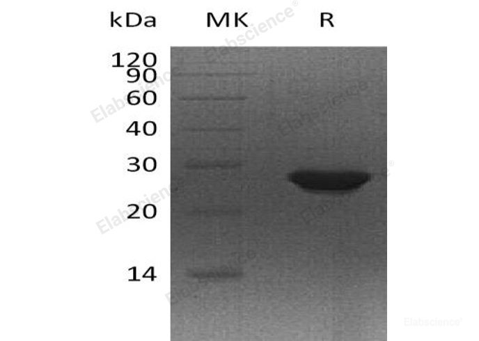 Recombinant Human 5-Formyltetrahydrofolate Cyclo-Ligase/MTHFS Protein(C-6His)-Elabscience