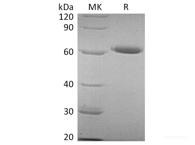Recombinant Human 5'-Nucleotidase/NT5E/5'-NT/CD73 Protein(C-6His)-Elabscience
