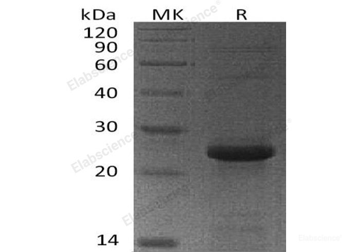Recombinant Human 6-O-Methylguanine-DNA Methyltransferase/MGMT Protein(N-6His)-Elabscience