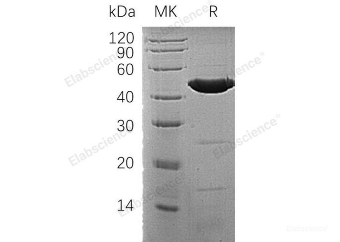 Recombinant Human ACADM/MCAD Protein(N-6His)-Elabscience