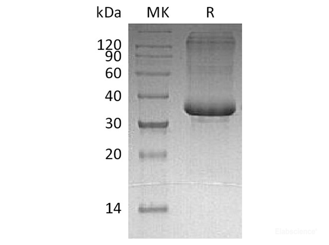 Recombinant Human Acrosomal Protein SP-10/ACRV1 Protein(C-6His)-Elabscience